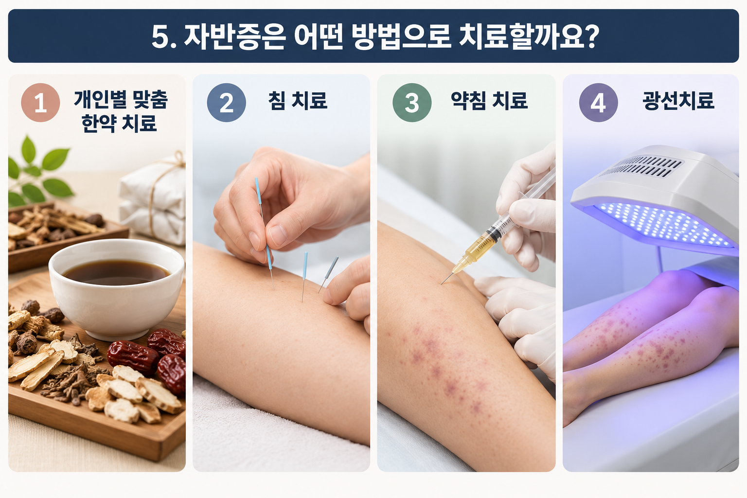 자반증 치료 방법 