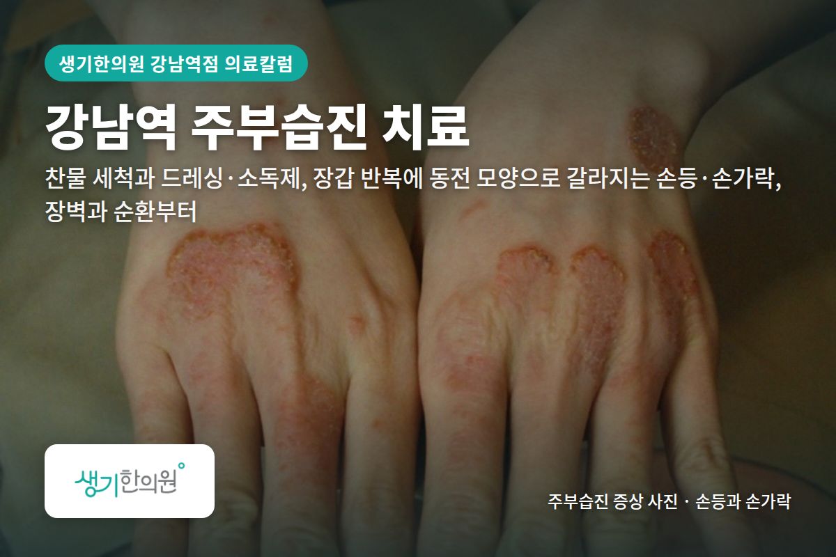 손등과 손가락 주부습진 증상 사진과 문구 「강남역 주부습진 치료, 찬물 세척과 드레싱·소독제, 장갑 반복에 동전 모양으로 갈라지는 손등·손가락, 장벽과 순환부터 · 생기한의원 강남역점」